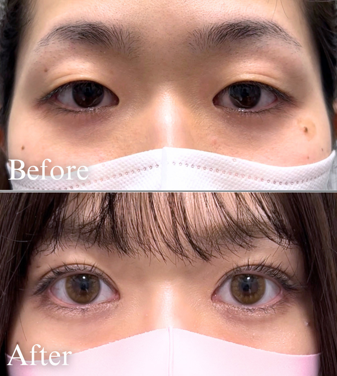 ビフォーアフター