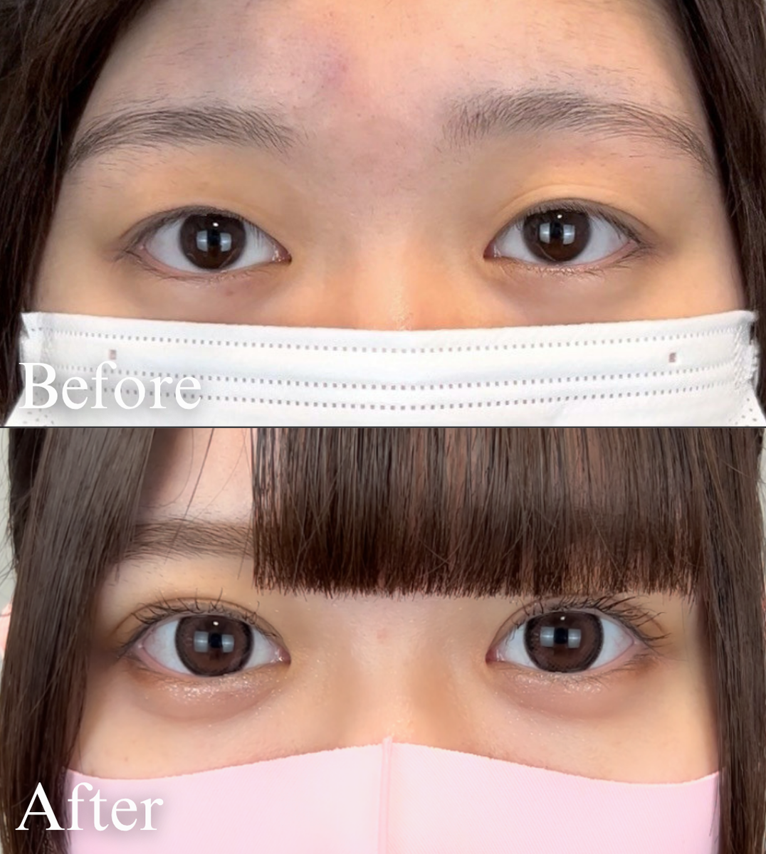 ビフォーアフター