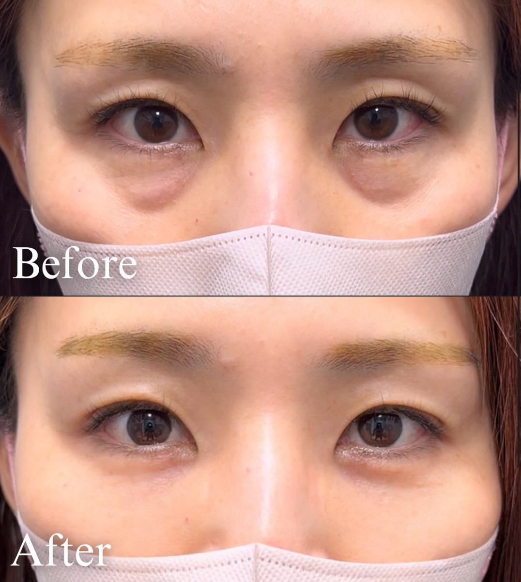 ビフォーアフター
